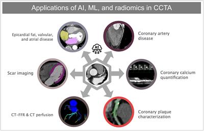 Artificial intelligence in coronary computed tomography angiography: Demands and solutions from a clinical perspective